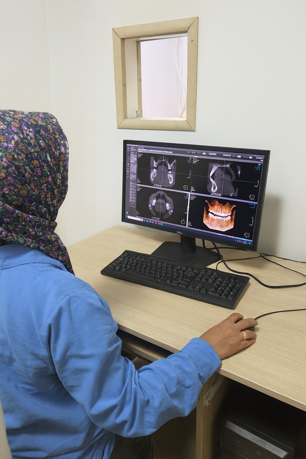 Eskişehir'de diş sağlığında yeni tomografi dönemi