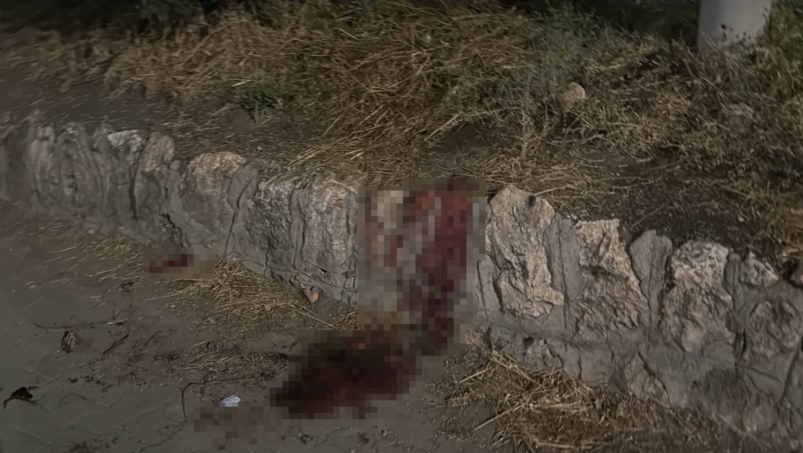 Eskişehir’de bıçaklı kavga: 17 yaşındaki çocuğun hayati tehlikesi sürüyor